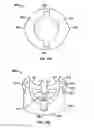 Fig. 12 - Fixation screw assembly