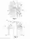 Fig. 04 - Method and apparatus for renal neuromodulation