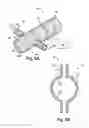 Fig. 06 - Method and apparatus for renal neuromodulation