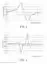 Fig. 03 - System and method for deep brain stimulation