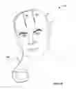 Fig. 03 - Collecting posture and activity information to evaluate therapy