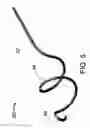 Fig. 07 - BUDDY WIRE FOR THE CORONARY ARTERIES