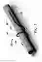 Fig. 08 - BUDDY WIRE FOR THE CORONARY ARTERIES