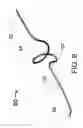 Fig. 09 - BUDDY WIRE FOR THE CORONARY ARTERIES