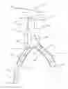 Fig. 01 - One-piece bifurcation graft