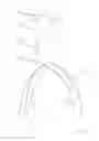 Fig. 02 - One-piece bifurcation graft