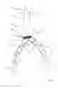 Fig. 05 - One-piece bifurcation graft