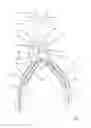 Fig. 06 - One-piece bifurcation graft