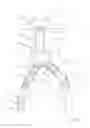 Fig. 07 - One-piece bifurcation graft