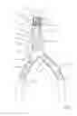 Fig. 08 - One-piece bifurcation graft