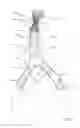 Fig. 09 - One-piece bifurcation graft