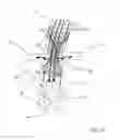 Fig. 10 - One-piece bifurcation graft