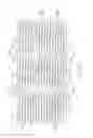 Fig. 09 - LONGITUDINALLY FLEXIBLE EXPANDABLE STENT