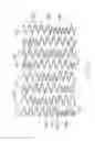 Fig. 13 - LONGITUDINALLY FLEXIBLE EXPANDABLE STENT