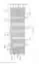 Fig. 18 - LONGITUDINALLY FLEXIBLE EXPANDABLE STENT