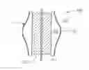 Fig. 01 - Prosthetic Valve Implantation Systems