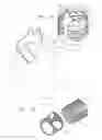 Fig. 02 - Prosthetic Valve Implantation Systems