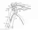 Fig. 01 - Soft tissue repair apparatus and method