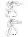 Fig. 02 - Soft tissue repair apparatus and method