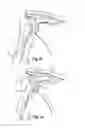 Fig. 03 - Soft tissue repair apparatus and method