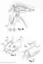 Fig. 04 - Soft tissue repair apparatus and method