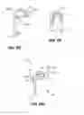 Fig. 22 - Soft tissue repair apparatus and method