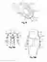 Fig. 28 - Soft tissue repair apparatus and method