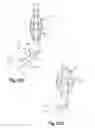 Fig. 33 - Soft tissue repair apparatus and method