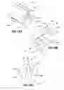 Fig. 34 - Soft tissue repair apparatus and method