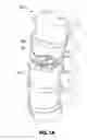 Fig. 02 - INTER-VERTEBRAL-BODY SPACER