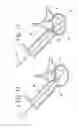 Fig. 07 - Interbody implant