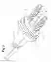 Fig. 03 - Prosthetic wrist implant