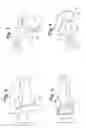 Fig. 06 - Prosthetic wrist implant