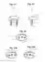 Fig. 11 - Prosthetic wrist implant
