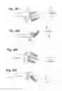 Fig. 12 - Prosthetic wrist implant
