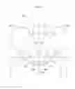 Fig. 02 - Hip joint device and method