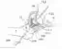 Fig. 01 - Medical device and method for treatment of hip joint