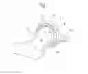 Fig. 02 - Medical device and method for treatment of hip joint