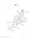 Fig. 12 - Medical device and method for treatment of hip joint