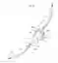 Fig. 16 - Medical device and method for treatment of hip joint