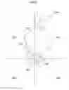 Fig. 03 - Hip joint device and method