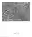 Fig. 03 - Nerve graft