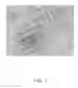 Fig. 08 - Nerve graft