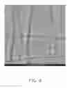 Fig. 09 - Nerve graft