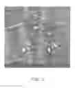 Fig. 12 - Nerve graft