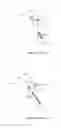 Fig. 02 - Prosthesis for a lower limb