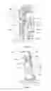 Fig. 04 - Prosthesis for a lower limb