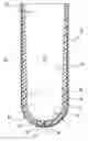 Fig. 01 - Prosthetic liner with continuous distal end area