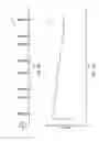 Fig. 08 - Fuel injector diagnostic for dual fuel engine