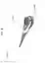 Fig. 14 - Thermometer with age specific feature selection